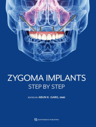 Title: Zygoma Implants: Step by Step, Author: Arun K. Garg