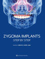 Zygoma Implants: Step by Step