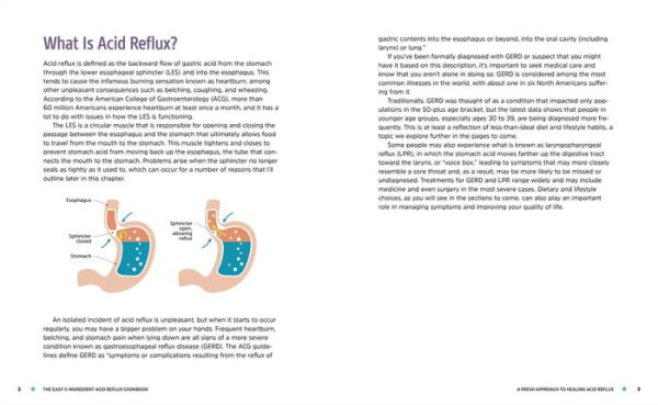 The Easy 5-Ingredient Acid Reflux Cookbook: Fuss-free Recipes for Relief from GERD and LPR