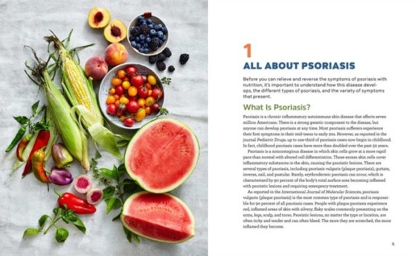 Psoriasis Cookbook + Meal Plan: A Complete Guide to Relief With 75 Anti-Inflammatory Recipes
