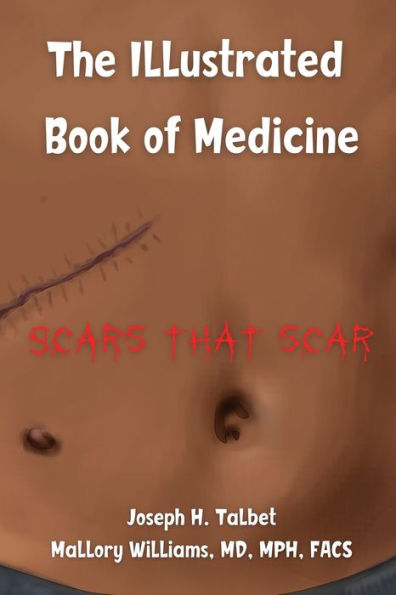 Scars that Scar