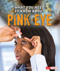 Title: What You Need to Know about Pink Eye, Author: Nancy Dickmann