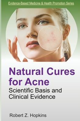 Natural Cures for Acne: Scientific Basis and Clinical Evidence