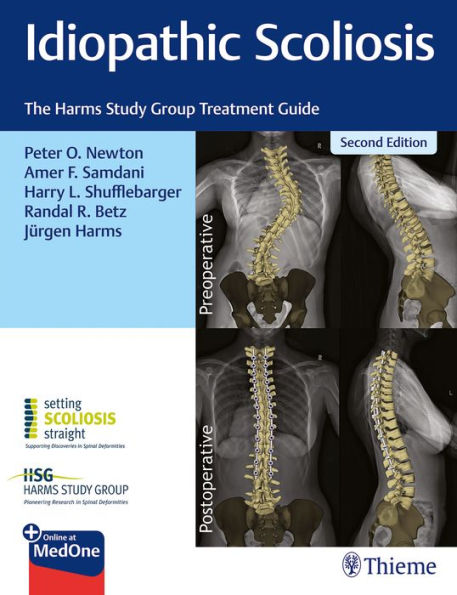 Idiopathic Scoliosis: The Harms Study Group Treatment Guide