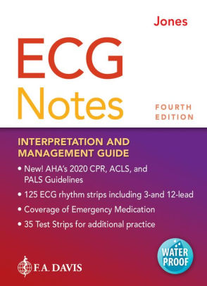 Ecg Notes Interpretation And Management Guide Edition 4 By Shirley A Jones Msed Mha Msn Emt P Rn 9781719641944 Other Format Barnes Noble