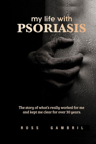 my life with PSORIASIS: The story of what finally worked for me and kept me clear for over 30 years!