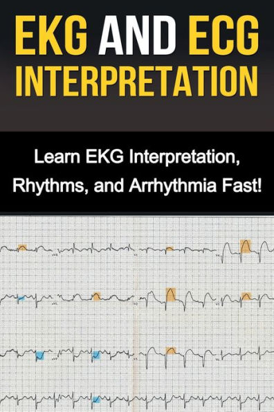EKG and ECG Interpretation: Learn Interpretation, Rhythms, Arrhythmia Fast!