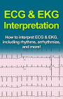 ECG & EKG Interpretation: How to interpret ECG & EKG, including rhythms, arrhythmias, and more!