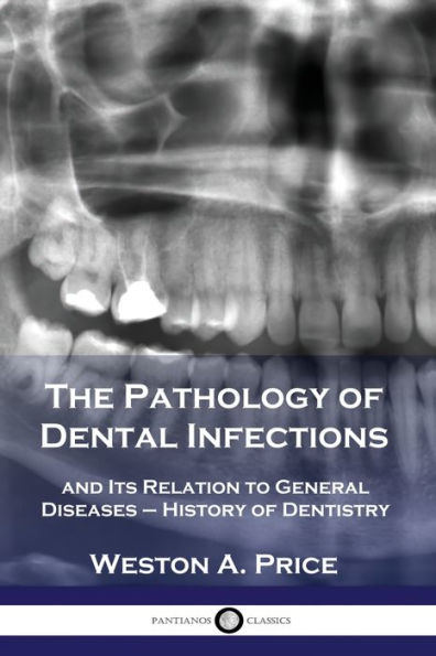 The Pathology of Dental Infections: and Its Relation to General Diseases - History Dentistry