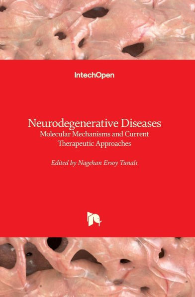 Neurodegenerative Diseases: Molecular Mechanisms and Current Therapeutic Approaches