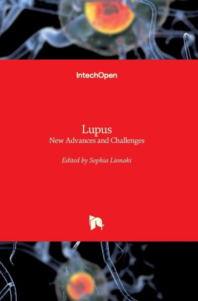 Lupus: New Advances and Challenges