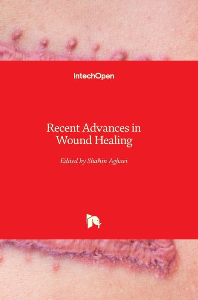 Recent Advances in Wound Healing