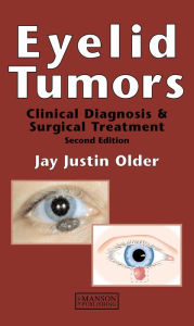 Title: Eyelid Tumors / Edition 2, Author: Jay Justin Older