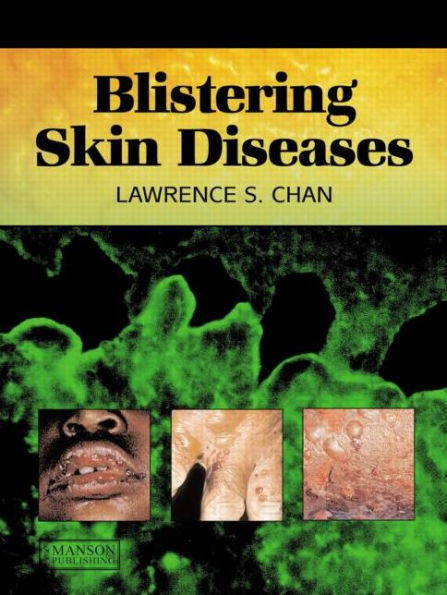 Blistering Skin Diseases / Edition 1