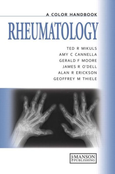 Rheumatology: A Color Handbook / Edition 1