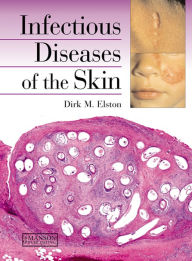 Title: Infectious Diseases of the Skin / Edition 1, Author: Dirk Elston