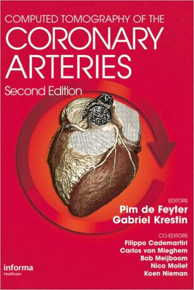 Computed Tomography of the Coronary Arteries / Edition 2