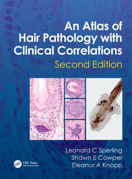 An Atlas of Hair Pathology with Clinical Correlations / Edition 2