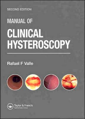 Manual of Clinical Hysteroscopy, Second Edition