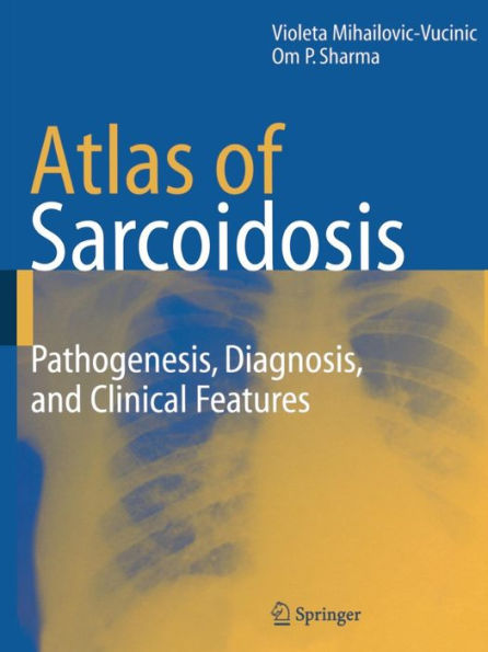 Atlas of Sarcoidosis: Pathogenesis, Diagnosis and Clinical Features / Edition 1