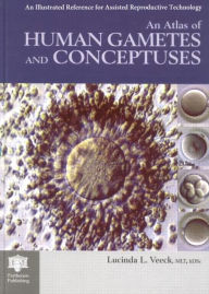 Title: An Atlas of Human Gametes and Conceptuses: An Illustrated Reference for Assisted Reproductive Technology / Edition 1, Author: Lucinda L. Veeck