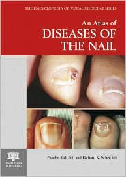 An Atlas of Diseases of the Nail
