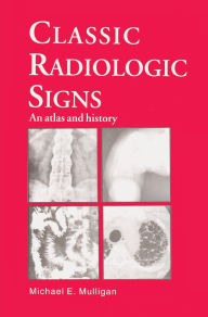 Title: Classic Radiologic Signs: An Atlas and History, Author: M.E. Mulligan