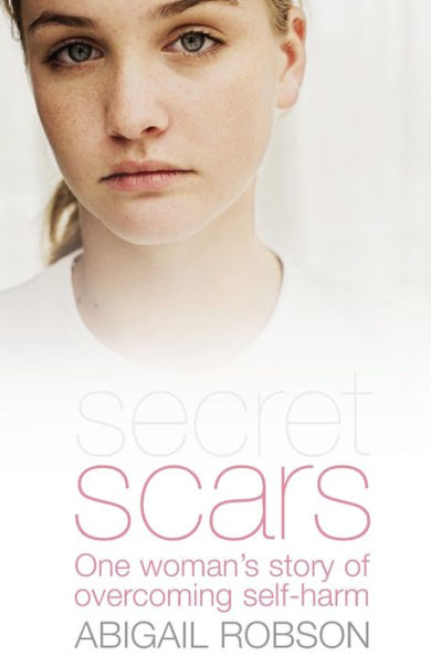 Secret Scars: One Woman's Story of Overcoming Self-Harm