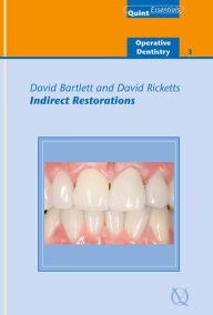 Title: Indirect Restorations, Author: David Bartlett