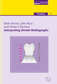 Title: Interpreting Dental Radiographs, Author: Keith Horner