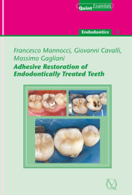 Title: Adhesive Restoration of Endodontically Treated Teeth, Author: Francesco Mannocci