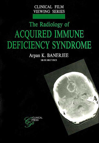 The Radiology of Acquired Immune Deficiency Syndrome (Clinical Film Viewing Series)