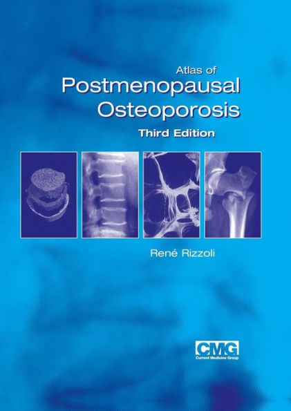 Atlas of Postmenopausal Osteoporosis: Third Edition / Edition 3