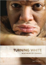 Title: Turning White, Author: Lee Thomas