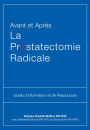 Avant et Après La Prostatectomie Radicale: Guide d'information et de Ressources