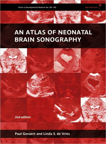 An Atlas of Neonatal Brain Sonography / Edition 2