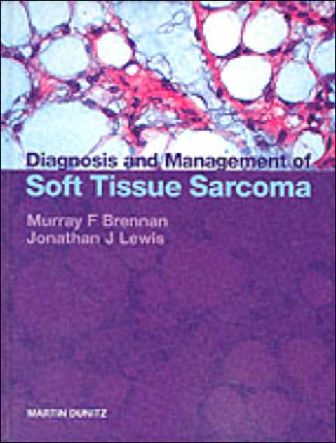 Diagnosis and Management of Soft Tissue Sarcoma by Murray Brennan ...