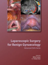 Title: Laparoscopic Surgery for Benign Gynaecology with DVDs, Author: Alfred Cutner