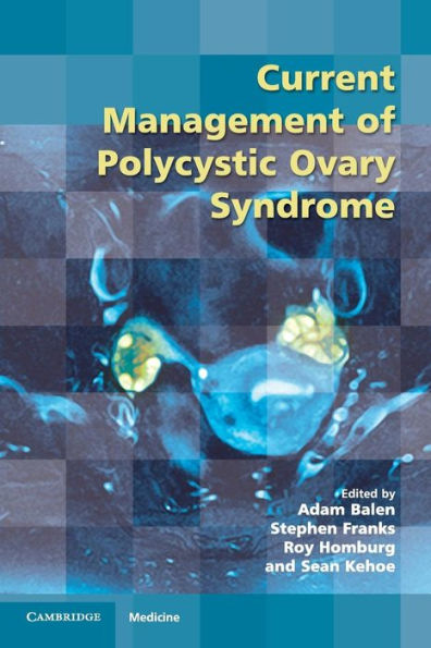 Current Management of Polycystic Ovary Syndrome