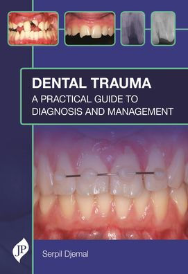 Dental Trauma: A Practical Guide to Diagnosis and Management