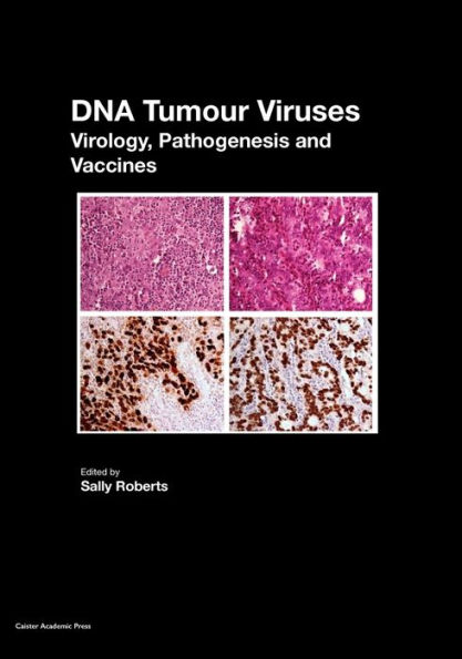 DNA Tumour Viruses: Virology, Pathogenesis and Vaccines