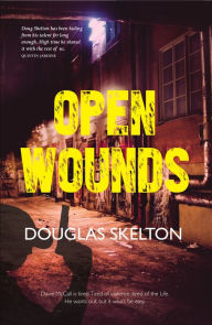 Title: Open Wounds, Author: Douglas Skelton