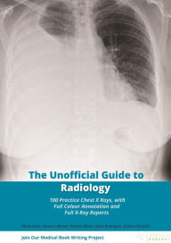 The Unofficial Guide to Radiology: 100 Practice Chest X Rays with Full Colour Annotations and Full X Ray Reports