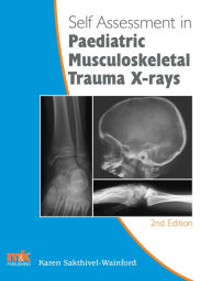 Title: Self-assessment in Paediatric Musculoskeletal Trauma X-rays, Author: Karen Sakthivel-Wainford