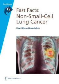 Title: Fast Facts: Non-Small-Cell Lung Cancer: NSCLC, Author: Mary O'Brien MD FRCP