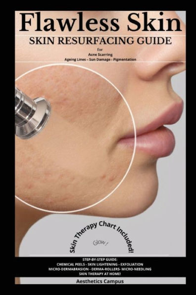 Flawless Skin: Skin Resurfacing Guide for Acne Scarring - Ageing Lines Sun Damage Pigmentation