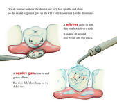 Alternative view 3 of Melvin the Magnificent Molar