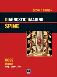 Title: Diagnostic Imaging: Spine: Published by Amirsys / Edition 2, Author: Jeffrey S. Ross