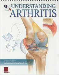 Title: Understanding Arthritis Flip Chart, Author: Continental Sales