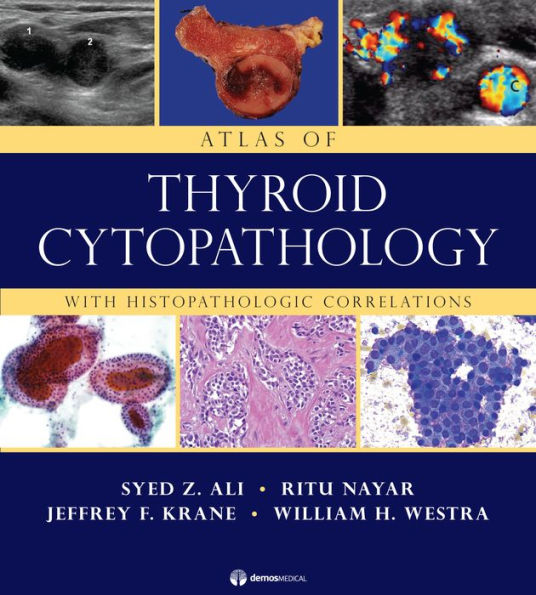 Atlas of Thyroid Cytopathology: With Histopathologic Correlations / Edition 1